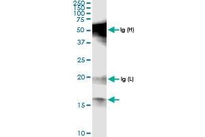 Immunoprecipitation of POLR1D transfected lysate using anti-POLR1D MaxPab rabbit polyclonal antibody and Protein A Magnetic Bead , and immunoblotted with POLR1D MaxPab rabbit polyclonal antibody (D01) . (POLR1D Antikörper  (AA 1-133))