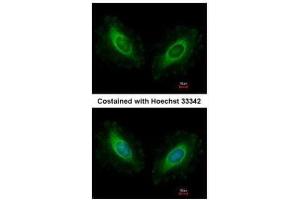 ICC/IF Image Immunofluorescence analysis of methanol-fixed HeLa, using Calmodulin 2, antibody at 1:500 dilution. (Calmodulin 2 Antikörper)