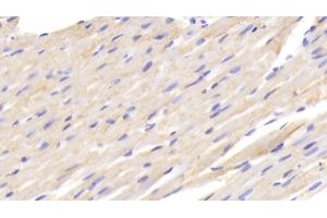 Immunohistochemistry (IHC) image for anti-Fatty Acid Binding Protein 1, Liver (FABP1) (AA 1-127) antibody (ABIN7440617)