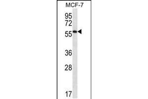 Western blot analysis in MCF-7 cell line lysates (35ug/lane). (SAAL1 Antikörper  (C-Term))