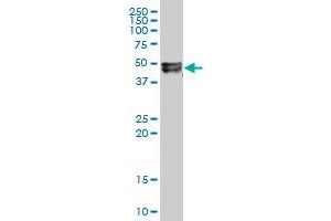 INHBB polyclonal antibody (A01), Lot # 060125JC01. (INHBB Antikörper  (AA 298-407))