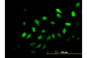 Immunofluorescence of monoclonal antibody to SURB7 on HeLa cell. (MED21 Antikörper  (AA 1-144))