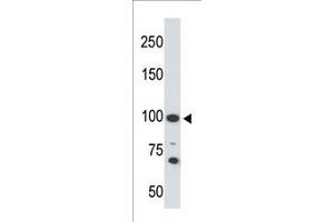 The anti-ACE2 C-term Pab f is used in Western blot to detect ACE2 in 293 cell lysate. (ACE2 Antikörper  (C-Term))