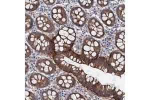 Immunohistochemical staining of human colon with TMTC3 polyclonal antibody  shows strong cytoplasmic and membranous positivity in glandular cells. (TMTC3 Antikörper)