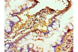 Immunohistochemistry of paraffin-embedded human small intestine tissue using ABIN7150218 at dilution of 1:100 (ALKBH2 Antikörper  (AA 1-261))