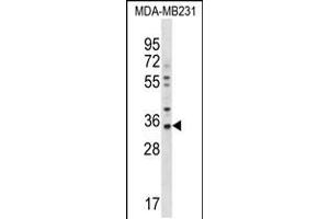 Western Blotting (WB) image for anti-Gap Junction Protein, beta 5, 31,1kDa (GJB5) (AA 89-119) antibody (ABIN5534074)