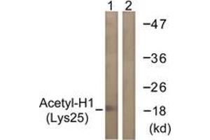 Western blot analysis of extracts from COS7 cells, treated with TSA 400nM 24h, using Histone H1 (Acetyl-Lys25) Antibody. (Histone H1 Antikörper  (acLys25))