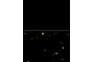 Image no. 3 for anti-C-Ros Oncogene 1 , Receptor tyrosine Kinase (ROS1) (AA 33-63), (N-Term) antibody (ABIN359936) (ROS1 Antikörper  (N-Term))