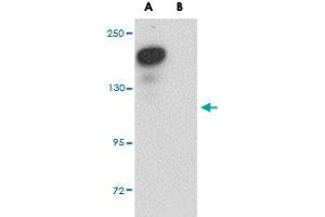 Western blot analysis of PLEKHM2 in rat brain tissue lysate with PLEKHM2 polyclonal antibody  at 0. (PLEKHM2 Antikörper  (C-Term))