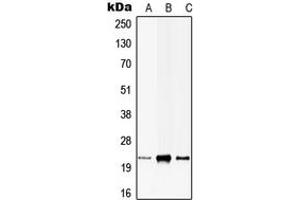 Western blot analysis of CIB1 expression in HEK293T (A), H9C2 (B), rat brain (C) whole cell lysates. (CIB1 Antikörper  (Center))