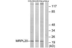 Western blot analysis of extracts from COLO cells, HUVEC cells and HeLa cells, using MRPL20 antibody.