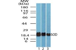 Image no. 1 for anti-Superoxide Dismutase antibody (ABIN1496240) (Superoxide Dismutase Antikörper)