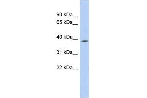 WB Suggested Anti-APOL6 Antibody Titration:  0. (APOL6 Antikörper  (Middle Region))