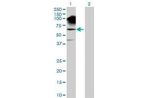 Western Blotting (WB) image for SNCAIP 293T Cell Transient Overexpression Lysate(Denatured) (ABIN1334628)