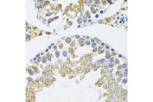 Immunohistochemistry of paraffin-embedded mouse testis using POLG2 antibody (ABIN5974040) at dilution of 1/100 (40x lens). (POLG2 Antikörper)