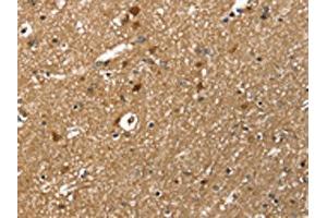 The image on the left is immunohistochemistry of paraffin-embedded Human brain tissue using ABIN7131518(TWF1 Antibody) at dilution 1/30, on the right is treated with fusion protein. (TWF1 Antikörper)