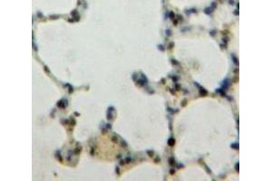 Used in DAB staining on fromalin fixed paraffin-embedded Lung tissue (KLF4 Antikörper  (AA 187-474))