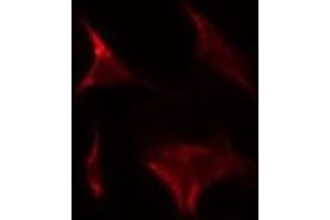 ABIN6275272 staining HeLa by IF/ICC. (NDUFA9 Antikörper  (Internal Region))