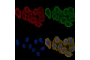 ABIN6262097 and ABIN6266556 staining Hela cells(24h of starvation treatment) by IF/ICC. (HSPA9 Antikörper  (C-Term))
