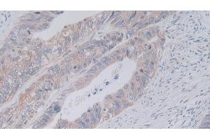 Immunohistochemistry (IHC) image for anti-Junctional Adhesion Molecule 2 (JAM2) (AA 74-250) antibody (ABIN7440674)