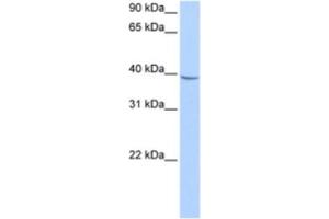 Western Blotting (WB) image for anti-Nudix (Nucleoside Diphosphate Linked Moiety X)-Type Motif 17 (NUDT17) antibody (ABIN2463190)