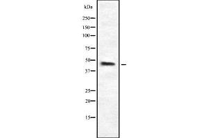 Western blot analysis of HPD using K562 whole cell lysates (HPD Antikörper  (C-Term))