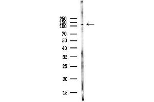 anti-MLK1/2 (pThr266), (pThr312) antibody