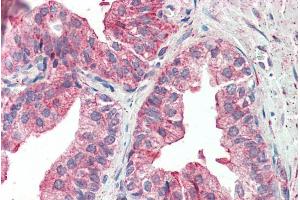 ABIN570690 (5µg/ml) staining of paraffin embedded Human Prostate. (KIF6 Antikörper  (Internal Region))