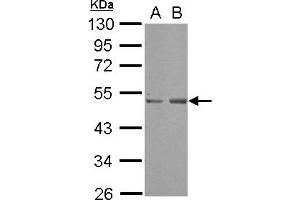 Western Blotting (WB) image for anti-SET Domain Containing (Lysine Methyltransferase) 7 (SETD7) (AA 1-203) antibody (ABIN1500902)