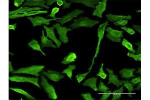 Immunofluorescence of monoclonal antibody to EMR4P on HeLa cell. (EMR4P Antikörper  (AA 21-93))