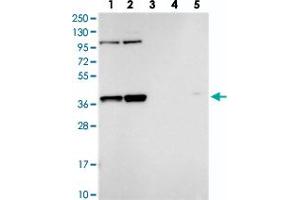 Western blot analysis of Lane 1: RT-4, Lane 2: U-251 MG, Lane 3: Human Plasma, Lane 4: Liver, Lane 5: Tonsil with FAM131A polyclonal antibody  at 1:250-1:500 dilution. (FAM131A Antikörper)