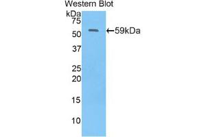 Western blot analysis of the recombinant protein. (N-Acetyl alpha-D-Glucosaminidase (AA 429-710) Antikörper)