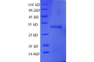 Ubiquitin-Conjugating Enzyme E2W (UBE2W) (AA 1-151), (full length) protein (His-SUMO Tag)