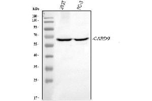 Western blot analysis of CARD9 using anti-CARD9 antibody (ABIN7599386).