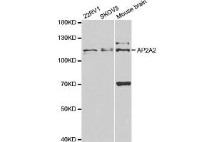 Western blot analysis of extracts of various cell lines, using AP2A2 antibody. (AP2A2 Antikörper)