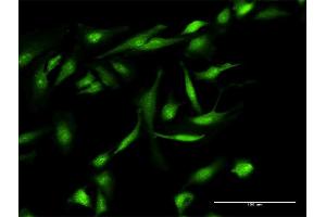 Immunofluorescence of purified MaxPab antibody to GEMIN7 on HeLa cell.