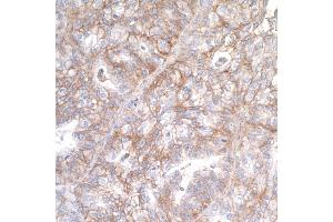 Immunohistochemistry (IHC) image for anti-CD276 (CD276) (AA 29-465) antibody (ABIN7455137)