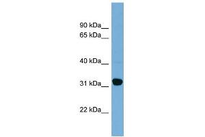 WB Suggested Anti-CBR1 Antibody Titration:  0. (CBR1 Antikörper  (Middle Region))