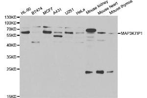 Western blot analysis of extracts of various cells, using TAB1 antibody. (TAB1 Antikörper)