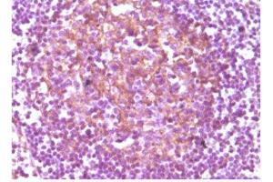 Immunohistochemistry (IHC) image for anti-CD14 (CD14) antibody (ABIN1843073) (CD14 Antikörper)