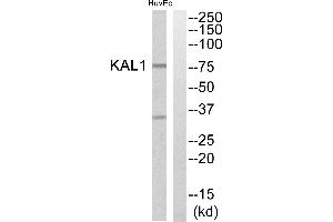 Western blot analysis of extracts from HuvEc cells, using KAL1 antibody. (KAL1 Antikörper)