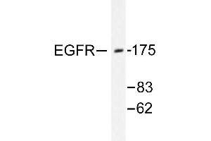 Image no. 1 for anti-Epidermal Growth Factor Receptor (EGFR) antibody (ABIN265396)