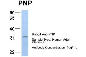 Host:  Rabbit  Target Name:  PNP  Sample Type:  Human Adult Placenta  Antibody Dilution:  1. (NP (Middle Region) Antikörper)