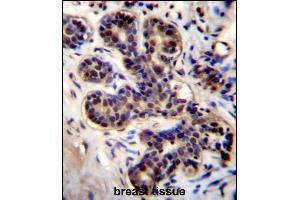 PROX2 Antibody (C-term) (ABIN656460 and ABIN2845744) immunohistochemistry analysis in formalin fixed and paraffin embedded human breast tissue followed by peroxidase conjugation of the secondary antibody and DAB staining.