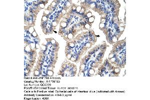 Human Intestine (ZNF785 Antikörper  (C-Term))
