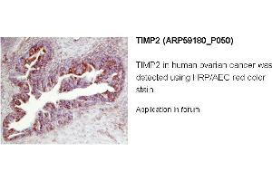 Image no. 1 for anti-Metalloproteinase Inhibitor 2 (TIMP2) (N-Term) antibody (ABIN2787967) (TIMP2 Antikörper  (N-Term))