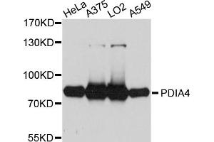 Western blot analysis of extracts of various cell lines, using PDIA4 antibody (ABIN5972424) at 1/1000 dilution. (PDIA4 Antikörper)