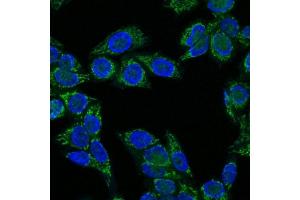 Immunofluorescence Analysis of HeLa cells labeling IGF-1 with IGF-1 Mouse Monoclonal Antibody (CTC05) labeled with CF647R (Green). (IGF1 Antikörper)