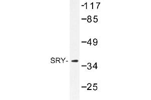 Image no. 1 for anti-Sex Determining Region Y (SRY) antibody (ABIN272215) (SRY Antikörper)