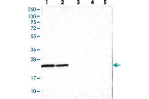 Western blot analysis of Lane 1: RT-4, Lane 2: U-251 MG, Lane 3: Human Plasma, Lane 4: Liver, Lane 5: Tonsil with SOX7 polyclonal antibody  at 1:100-1:250 dilution. (PINX1 Antikörper)